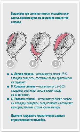 матка кувелера фото